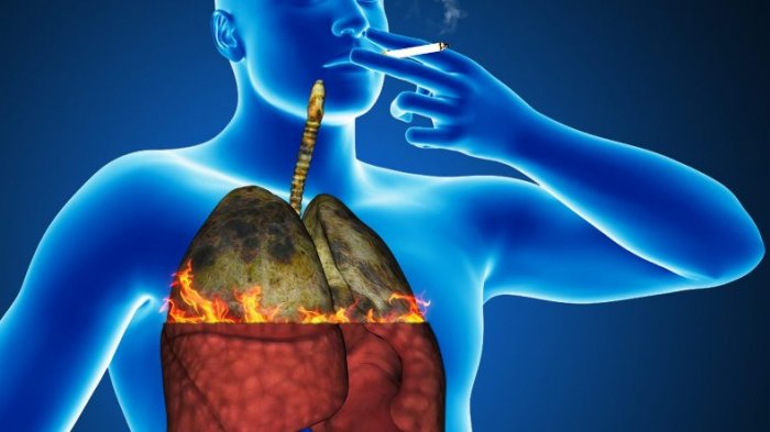 Penyakit Kronis Yang Bisa Menyerang Perokok Pasif