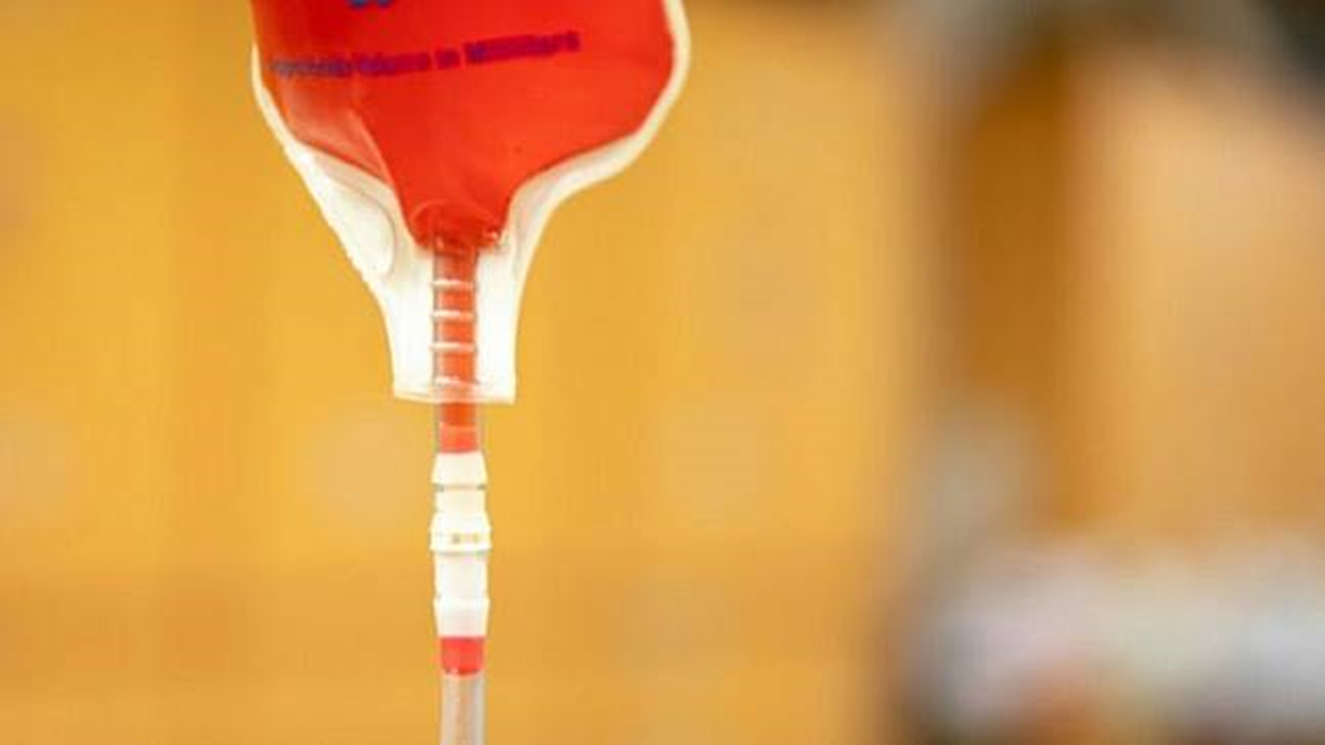 Bolehkah Melakukan Donor Darah saat Hamil?