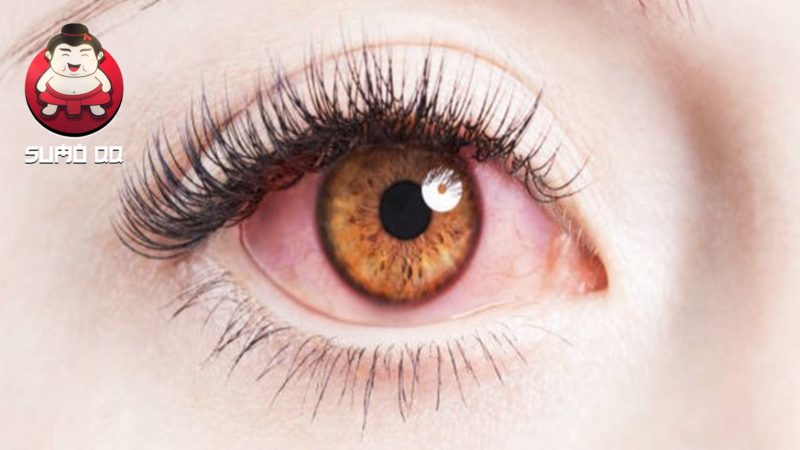 5 Cara Melindungi Kesehatan Mata dari Polusi