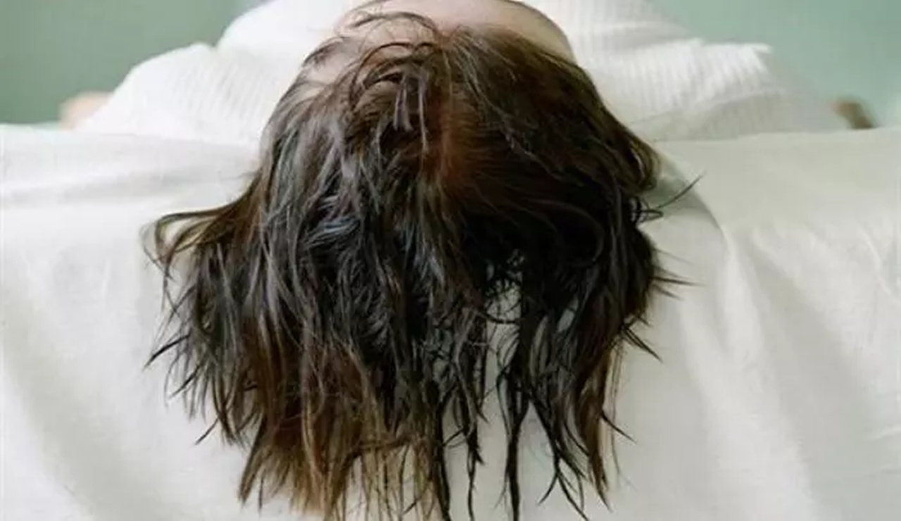 Sering Tidur dengan Rambut Basah? Hindari Terkena Penyakit Ini