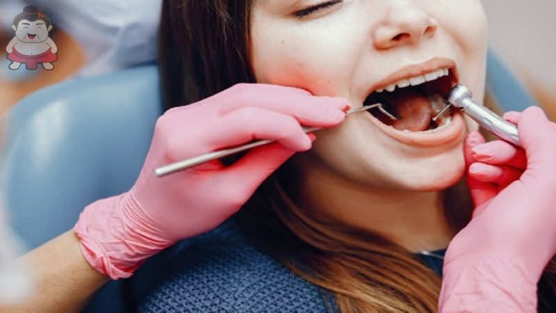 5 Mitos yang Beredar Tentang Gigi Berlubang